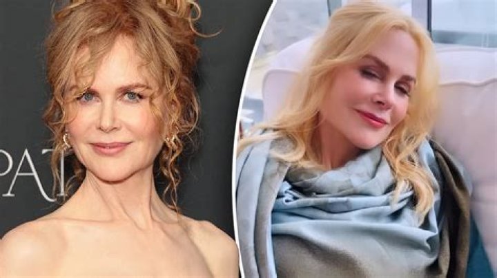 Exploring The Complexion Of Nicole Kidman: Does She Have Freckles?