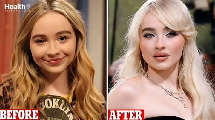 Exploring The Transformation: Sabrina Carpenter And Her Plastic Surgery Journey