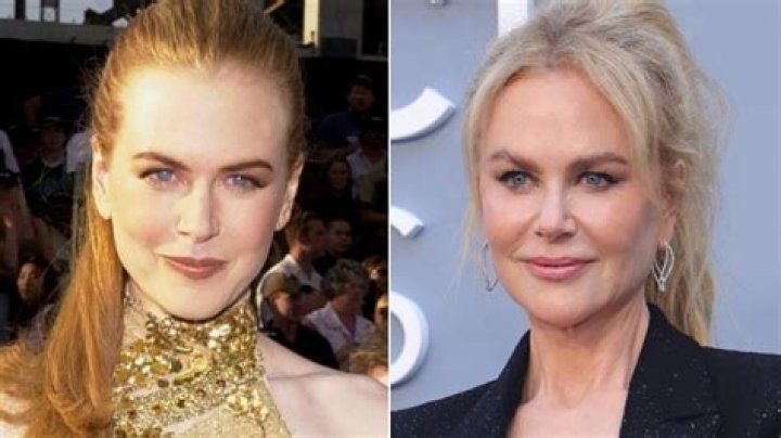 Has Nicole Kidman Had A Boob Job? Unraveling The Truth Behind The Rumors