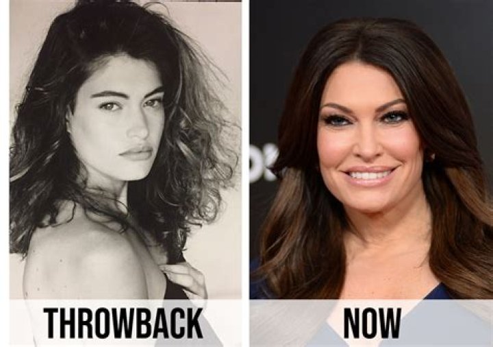 Kimberly Guilfoyle's Plastic Surgery Journey: Before And After